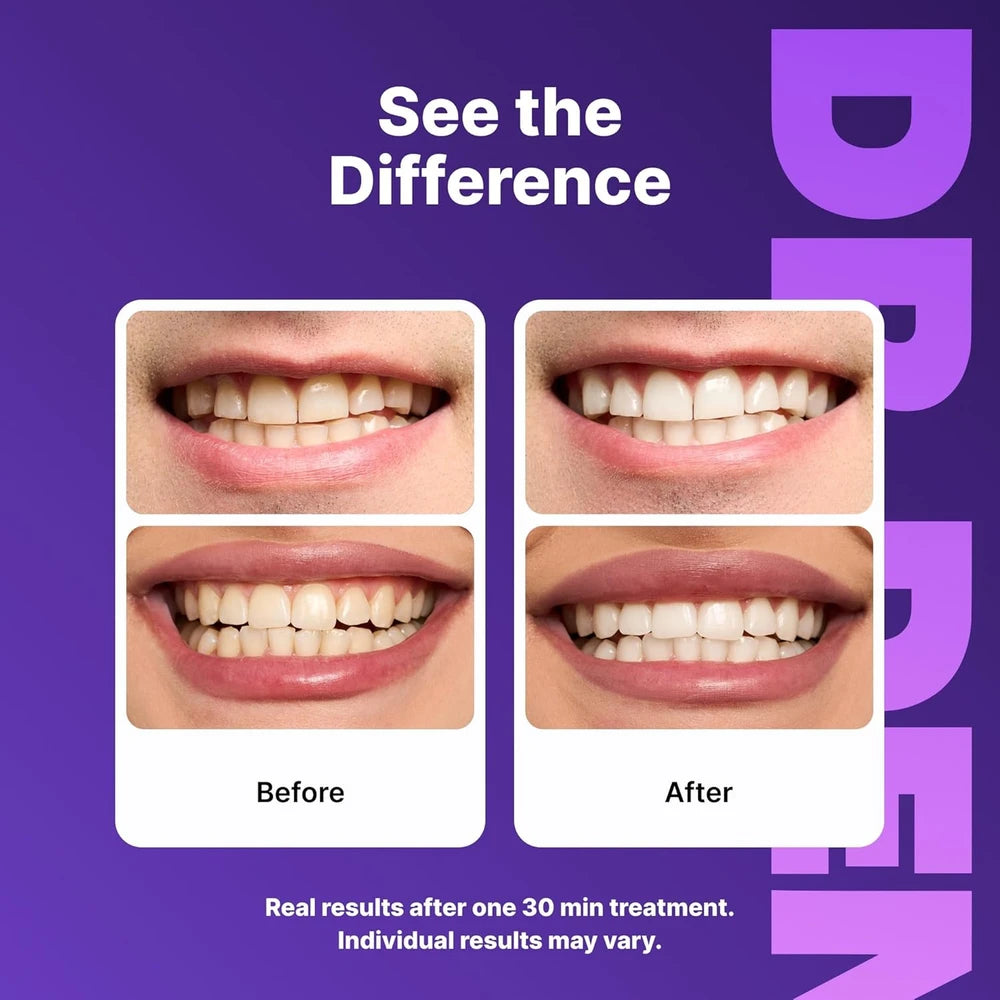 DrDent Purple Teeth Whitening Strips